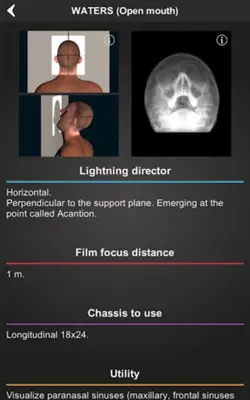 RX - Radiographic Positioning android App screenshot 0