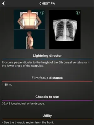 RX - Radiographic Positioning android App screenshot 1