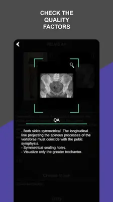 RX - Radiographic Positioning android App screenshot 3