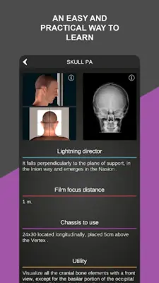 RX - Radiographic Positioning android App screenshot 6